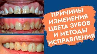 Зуб изменил цвет. Зуб потемнел. Причины. Как помочь?