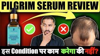 Pilgrim Advanced Hair Growth Serum Review - Genuine Tips