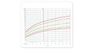 Growth Monitoring in Children: Weight, Length, Height, and Head Circumference | Stanford