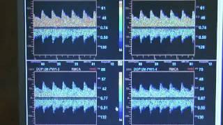 Multigon TOC 2M Transcranial Doppler