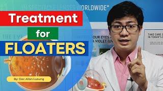 Treatment for FLOATERS