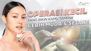 Brow Lift di #RuangOperasi Plasthetic Clinic | Klinik Kecantikan Bersertifikasi