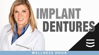 Implant Supported Dentures | The Wellness Hour | Stanley Dentistry