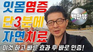[잇몸염증 자연치료]치은염 치주염 단3분즉시 효과/간단하게 잇몸치료이빨이 치주염으로 아플때/ 잇몸고름 치통 순삭 경험하고 바로 간단한 자연치료 건강꿀팁 공유