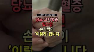 당뇨 고지혈증 있으면 손가락이 ‘이렇게’ 변합니다! #건강