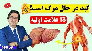 13 نشانه عجیب آسیب های کبدی! | زودتر آگاه شوید و کبد خود را درمان کنید!