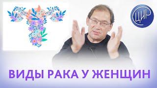 Онкогинекология. Рак в гинекологии. Локализации онкологии у женщин. Рассказывает доктор Гузов.