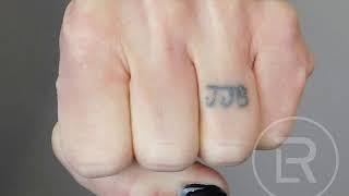 JBB Ring Finger Laser Tattoo Removal