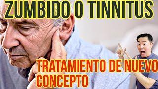 ¡Mejora dramática de tinnitus!  ¡Puedes hacerlo en casa!  ejercicio para zumbido del oído