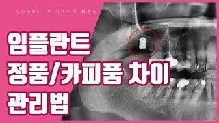 임플란트 관리법, 정품과 카피품은 수명 차이가 있을까?