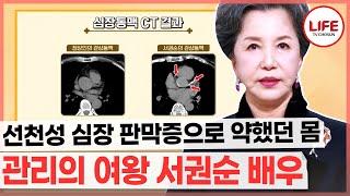 [#건강면세점] 완벽히 관리하는 서권순도, 심장에 이상 징후가 보인다?!  (TV CHOSUN 220403 방송)