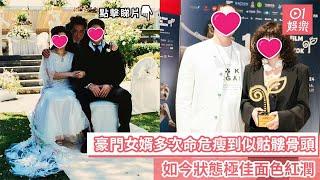 豪門女婿多次命危瘦到似骷髏骨頭　如今狀態極佳面色紅潤｜01娛樂｜賭王千金｜豪門女婿