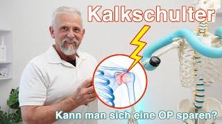 Kalkschulter: Das hilft wirklich  Übungen | Behandlung | Lösung