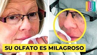 La milagrosa nariz de Joy Milne…