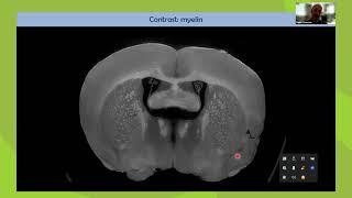 X-ray phase contrast imaging: a versatile tool for neuroscientists