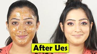 5 Ways to Get Clear Skin Pigmentation Removal - Pigmentation से छुटकारा