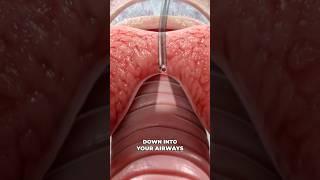 Bronchoscopy (3D Animation)