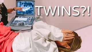 SHOCKING ULTRASOUND... TWINS?! | LAUREN & ARIE