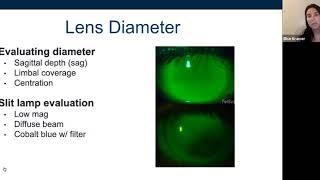 Student Webinar: Troubleshooting Scleral Lenses 5/14/2020