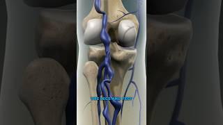 What causes varicose veins? (3D Animation)