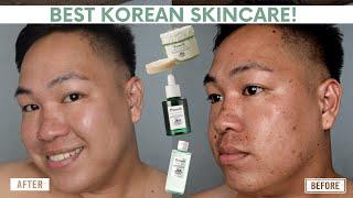 HOW I GOT RID OFF ACNE BREAKOUTS? PARNELL SKINCARE PRODUCTS REVIEW - BEST KOREAN SKINCARE 2023?