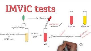 IMViC Tests |  Procedure and Principle | Microbiology