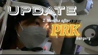 How’s my PRK surgery After 2 Months | A Quick Update | kriste_lyka