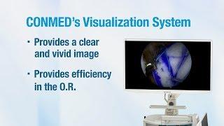 CONMED IM8000 Visualization System - CONMED Product Video