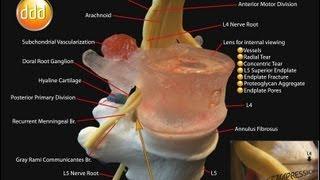 Spinal Model - Professional LxH Model by Dynamic Disc Designs Corp.