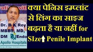 क्या पेनिस इम्प्लांट से लिंग का साइज बढ़ता है या नहीं | Penis implant for Penis Enlargement Length DR