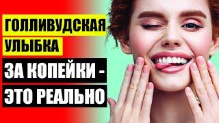  Съемные виниры верхние и нижние  Установка виниров казань