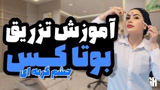 آموزش تزریق بوتاکس چشم گربه ای#بوتاکس #ژل_لب