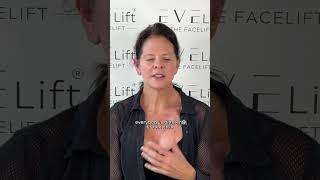 Patient Results Just 7 Days After EVE Lift™ | Eden Plastic Surgery: Dr. Ali Charafeddine, MD