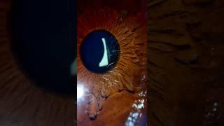 I Put My Eye under Microscope