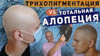 Трихопигментация vs Тотальная алопеция. Scalp micropigmentation by Andrey Afanasev