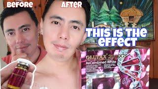 CORRECT USE OF GLUTAX 2000GS GLUTATHIONE Drip | THE BEST & Most Effective | Nurse Review