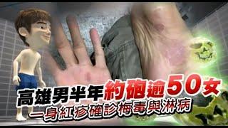 【獨家／風流苦果】高雄男半年約砲逾50女　一身紅疹確診梅毒與淋病 | 蘋果新聞網