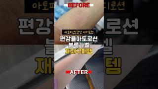 광고내돈내산 바디로션 인생템 (아토피 가려움 없애는 법) /삶의질 상승템