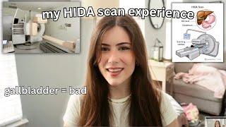 My HIDA Scan Experience (i need my gallbladder taken out)