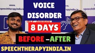 SLP Sanjay Kumar: Pre-Post | Sulcus Vocalis | Singer | Voice Therapy | Within 8 Days | Since 2010