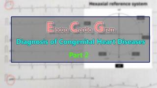 ECG: Diagnosis of Congenital heart diseases PART 2