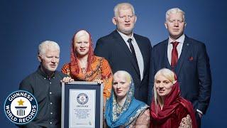 We're Asian, Albino and Beautiful - Guinness World Records