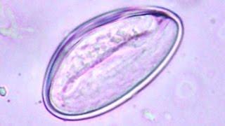 SCARY! Moving human pinworm - movement inside the egg - Enterobius vermicularis