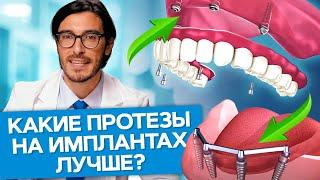 Какие протезы на имплантах лучше? Какие протезы на имплантах лучше выбрать: съемные или несъемные?