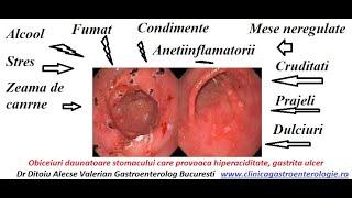 Cum calmam aciditatea gastrica prin regim