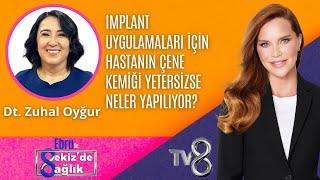 IMPLANT UYGULAMALARINDA ÇENE KEMİĞİ YETERSİZCE NELER YAPILIR? | DT.ZUHAL OYĞUR | 8'de Sağlık