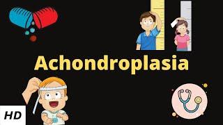 Achondroplasia, Causes, Signs and Symptoms, Diagnosis and Treatment.