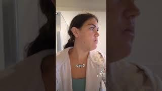 Jaw Surgery Recovery Day 1-5