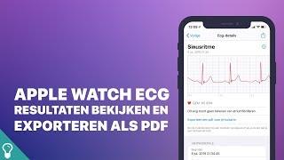 Mini screencast: Apple Watch ECG resultaten bekijken en exporteren als pdf