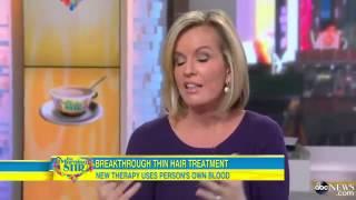 PRP for Hair Loss | Revolution Health PRP